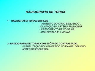 RADIOGRAFIA DE TORAX

1 – RADIOGRAFIA TORAX SIMPLES
                        – AUMENTO DO ATRIO ESQUERDO ,
                        -DILATAÇÃO DA ARTÉRIA PULMONAR
                        - CRESCIMENTO DE VD SE HP.
                        - CONGESTÃO PULMONAR



2- RADIOGRAFIA DE TORAX COM ESÔFAGO CONTRASTADO.
           -VISUALIZAÇÃO DO 3 INVERTIDO NO EXAME OBLÍQUO
           ANTERIOR ESQUERDA .
 