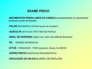 EXAME FÍSICO

-MOVIMENTOS PENDULARES DA CABEÇA acompanhando os movimentos
cardíacos (sinal de Musset)

-PULSO EM MARTELO D’AGUA (pulos de Corrigam)

-AUSCULTA DE PULSO TIPO TIRO DE PISTOLA

-SINAL DE DUROZIEZ (sopro vai –vem nas artérias femurais)

-PA   GRANDE DIFERENCIAL

-ICTUS – PARA BAIXO , FORA (esquerdo, difuso), GLOBOSO

-SOPRO PROTO DIASTÓLICO REGURGITATIVO

-OSCILAÇÃO DA VALVULA (SINAL DE MUELLER)
 