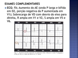 EXAMES COMPLEMENTARES
 ECG: FA; Aumento do AE (onda P larga e bífida
em D2, porção negativa da P aumentada em
V1); Sobrecarga de VD com desvio do eixo para
direita, R ampla em V1 e V2, S ampla em V5 e
V6.
 