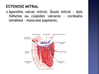 ESTENOSE MITRAL
 Aparelho valvar mitral: Ânulo mitral – dois
folhetos ou cúspides valvares – cordoália
tendínea – músculos papilares.
 