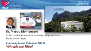 XXXIII Jornada SOLACI
Managua, Nicarágua
29 – 30 Septembro 2017
Intervenções na Estenose Mitral
Valvoplastia Mitral
 