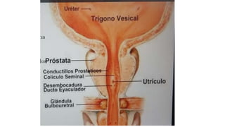 Valvula de uretra posterior