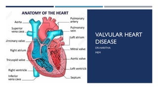 Valvar Heart valvular disease - Basic concept.pptx