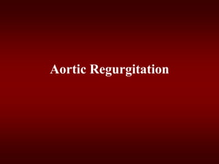 Aortic Regurgitation
 