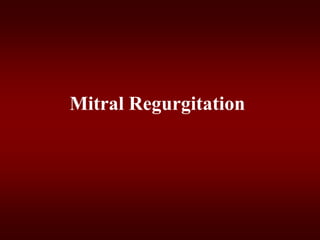 Mitral Regurgitation
 