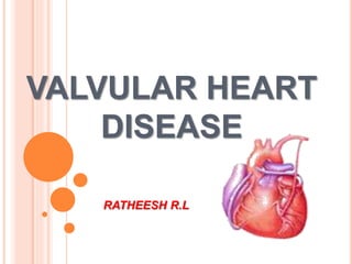 VALVULAR HEART
DISEASE
RATHEESH R.L
 