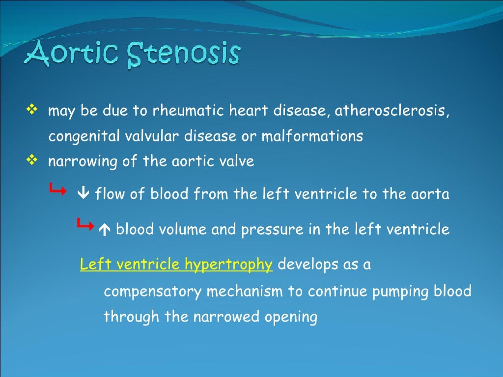 Valvular Heart Disease Valvular heart disease