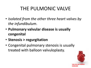 VALVULAR HEART
DISEASE
THE PULMONIC VALVE
• Isolated from the other three heart valves by
the infundibulum.
• Pulmonary valvular disease is usually
congenital
• Stenosis > regurgitation
• Congenital pulmonary stenosis is usually
treated with balloon valvuloplasty.
 