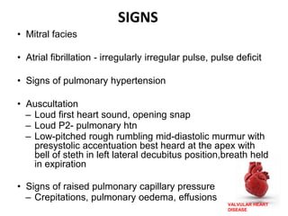 VALVULAR HEART
DISEASE
SIGNS
• Mitral facies
• Atrial fibrillation - irregularly irregular pulse, pulse deficit
• Signs of pulmonary hypertension
• Auscultation
– Loud first heart sound, opening snap
– Loud P2- pulmonary htn
– Low-pitched rough rumbling mid-diastolic murmur with
presystolic accentuation best heard at the apex with
bell of steth in left lateral decubitus position,breath held
in expiration
• Signs of raised pulmonary capillary pressure
– Crepitations, pulmonary oedema, effusions
 