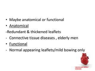 VALVULAR HEART
DISEASE
• Maybe anatomical or functional
• Anatomical
-Redundant & thickened leaflets
- Connective tissue diseases , elderly men
• Functional
- Normal appearing leaflets/mild bowing only
 