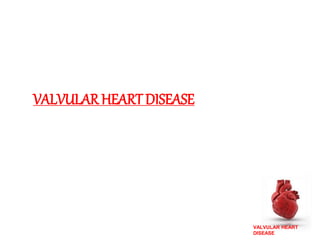 VALVULAR HEART
DISEASE
VALVULAR HEART DISEASE
 