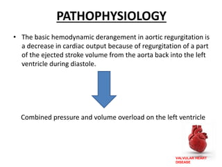 VALVULAR HEART
DISEASE
PATHOPHYSIOLOGY
• The basic hemodynamic derangement in aortic regurgitation is
a decrease in cardiac output because of regurgitation of a part
of the ejected stroke volume from the aorta back into the left
ventricle during diastole.
Combined pressure and volume overload on the left ventricle
 