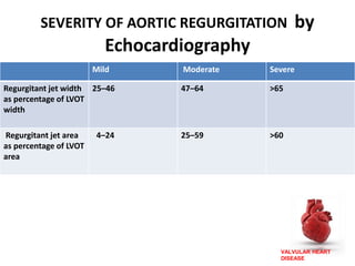 VALVULAR HEART
DISEASE
SEVERITY OF AORTIC REGURGITATION by
Echocardiography
• Mild Moderate Severe
Regurgitant jet width
as percentage of LVOT
width
25–46 47–64 >65
Regurgitant jet area
as percentage of LVOT
area
4–24 25–59 >60
 
