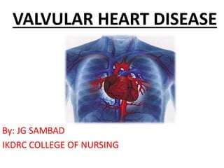 VALVULAR HEART DISEASE
By: JG SAMBAD
IKDRC COLLEGE OF NURSING
 