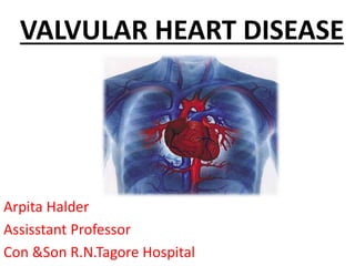 VALVULAR HEART DISEASE
Arpita Halder
Assisstant Professor
Con &Son R.N.Tagore Hospital
 