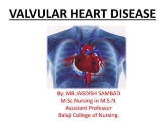 VALVULAR HEART DISEASE
By: MR.JAGDISH SAMBAD
M.Sc.Nursing in M.S.N.
Assistant Professor
Balaji College of Nursing.
 