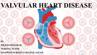 VALVULAR HEART DISEASE
BY
MR.RAVISHANKAR
NURSING TUTOR
OJASWINI NURSING COLLEGE, SAGAR
 