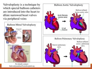 Valvar VALVULAR HEART DISEASE.ppt