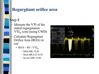 Valvular heart disease assessment of lesion severity | PPT