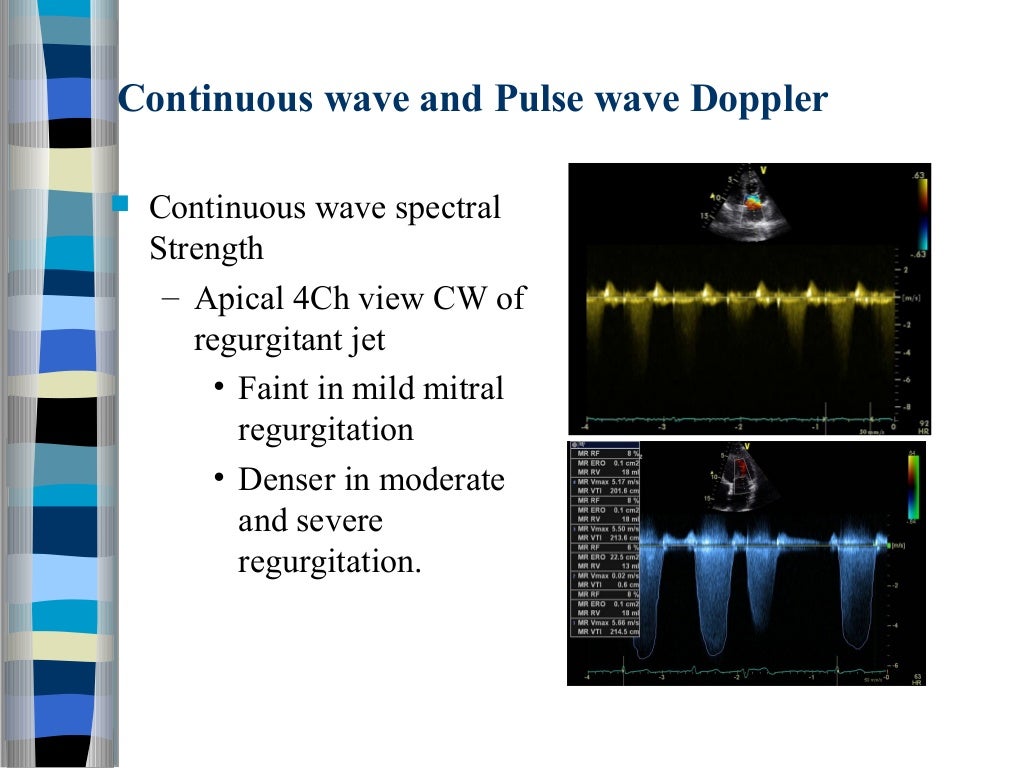 Valvular heart disease assessment of lesion severity
