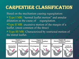 valvular heart disease anaesthesia considerations.ppt