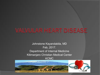 Johnstone Kayandabila, MD
Feb, 2017.
Department of Internal Medicine
Kilimanjaro Christian Medical Center
KCMC
 