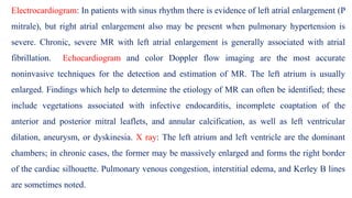 Electrocardiogram: In patients with sinus rhythm there is evidence of left atrial enlargement (P
mitrale), but right atrial enlargement also may be present when pulmonary hypertension is
severe. Chronic, severe MR with left atrial enlargement is generally associated with atrial
fibrillation. Echocardiogram and color Doppler flow imaging are the most accurate
noninvasive techniques for the detection and estimation of MR. The left atrium is usually
enlarged. Findings which help to determine the etiology of MR can often be identified; these
include vegetations associated with infective endocarditis, incomplete coaptation of the
anterior and posterior mitral leaflets, and annular calcification, as well as left ventricular
dilation, aneurysm, or dyskinesia. X ray: The left atrium and left ventricle are the dominant
chambers; in chronic cases, the former may be massively enlarged and forms the right border
of the cardiac silhouette. Pulmonary venous congestion, interstitial edema, and Kerley B lines
are sometimes noted.
 
