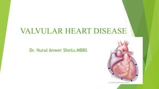 VALVULAR HEART DISEASE
Dr. Nurul Anwer Shetu.MBBS
 