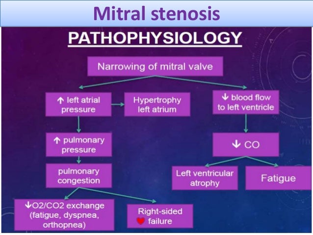 Valvular heart disease for post graduates