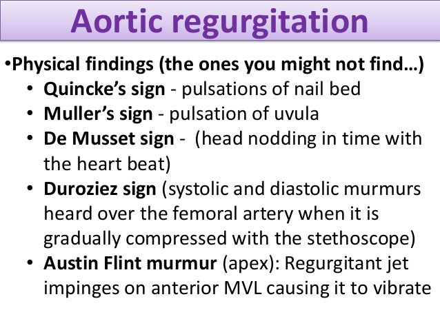 Valvular Heart Disease For Post Graduates