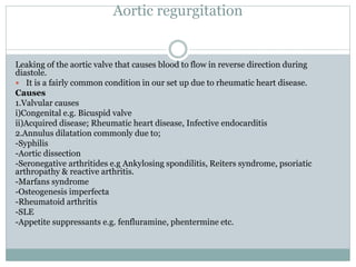 Aortic regurgitation
Leaking of the aortic valve that causes blood to flow in reverse direction during
diastole.
 It is a fairly common condition in our set up due to rheumatic heart disease.
Causes
1.Valvular causes
i)Congenital e.g. Bicuspid valve
ii)Acquired disease; Rheumatic heart disease, Infective endocarditis
2.Annulus dilatation commonly due to;
-Syphilis
-Aortic dissection
-Seronegative arthritides e.g Ankylosing spondilitis, Reiters syndrome, psoriatic
arthropathy & reactive arthritis.
-Marfans syndrome
-Osteogenesis imperfecta
-Rheumatoid arthritis
-SLE
-Appetite suppressants e.g. fenfluramine, phentermine etc.
 