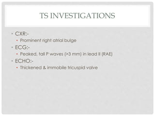 TS INVESTIGATIONS
• CXR:-
• Prominent right atrial bulge
• ECG:-
• Peaked, tall P waves (>3 mm) in lead II (RAE)
• ECHO:-
• Thickened & immobile tricuspid valve
 
