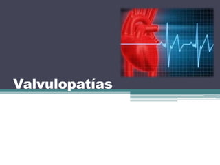 Valvulopatías 
 