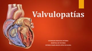 Valvulopatías
INTERNADO MEDICINA INTERNA
HOSPITAL DE VICTORIA
INTERNA MARÍA BELÉN LÓPEZ ESCALONA
 