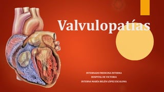 Valvulopatías
INTERNADO MEDICINA INTERNA
HOSPITAL DE VICTORIA
INTERNA MARÍA BELÉN LÓPEZ ESCALONA
 