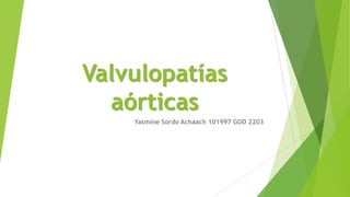 Valvulopatías
aórticas
Yasmine Sordo Achaach 101997 GOD 2203
 