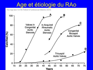 Age et étiologie du RAo

 