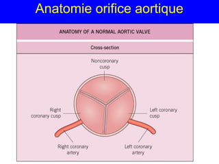 Anatomie orifice aortique

 
