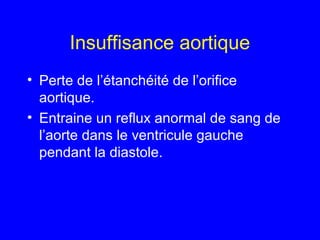 Insuffisance aortique
• Perte de l’étanchéité de l’orifice
aortique.
• Entraine un reflux anormal de sang de
l’aorte dans le ventricule gauche
pendant la diastole.

 