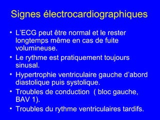 Signes électrocardiographiques
• L’ECG peut être normal et le rester
longtemps même en cas de fuite
volumineuse.
• Le rythme est pratiquement toujours
sinusal.
• Hypertrophie ventriculaire gauche d’abord
diastolique puis systolique.
• Troubles de conduction ( bloc gauche,
BAV 1).
• Troubles du rythme ventriculaires tardifs.

 