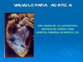 VALVULOPATIA  AORTICA DRA. MARIA DE  LA LUZ BAUTISTA SERVICIO DE CARDIO LOGIA HOSPITAL GENERAL DE MEXICO, O.D. 