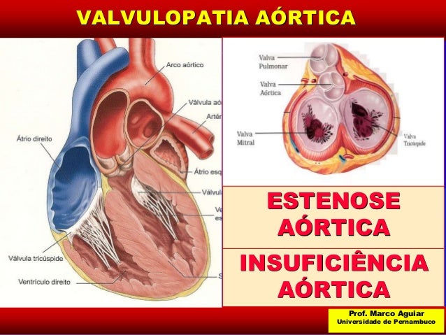 perfil clinico epidemiologico de hipertensao arterial sistemica perfil clinico epidemiologico de hipertensao arterial sistemica