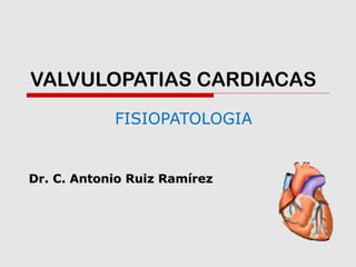 VALVULOPATIAS CARDIACAS
FISIOPATOLOGIA
Dr. C. Antonio Ruiz RamírezDr. C. Antonio Ruiz Ramírez
 