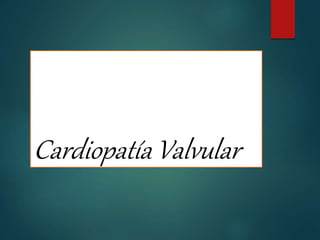 Cardiopatía Valvular
 