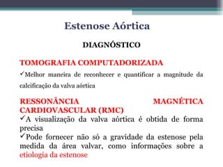 DIAGNÓSTICO
TOMOGRAFIA COMPUTADORIZADA
Melhor maneira de reconhecer e quantificar a magnitude da
calcificação da valva aórtica
RESSONÂNCIA MAGNÉTICA
CARDIOVASCULAR (RMC)
A visualização da valva aórtica é obtida de forma
precisa
Pode fornecer não só a gravidade da estenose pela
medida da área valvar, como informações sobre a
etiologia da estenose
Estenose Aórtica
 