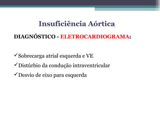 DIAGNÓSTICO - ELETROCARDIOGRAMA:
Sobrecarga atrial esquerda e VE
Distúrbio da condução intraventricular
Desvio de eixo para esquerda
Insuficiência Aórtica
 