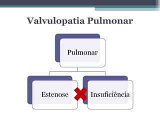 Valvulopatia Pulmonar
 