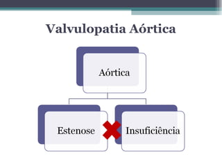 Valvulopatia Aórtica
 