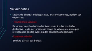 Valvulopatias
• Lesões de diversas etiologias que, anatomicamente, podem ser
expressas:
- Insuficiência valvular
Desaparecimento das bordas livres das válvulas por lesão
destrutiva, lesão perfurante no corpo da válvula ou ainda por
retração das bordas livres ou das cordoalhas tendinosas
-Estenose valvular
Soldura parcial das bordas
 