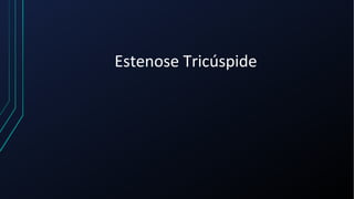 Estenose Tricúspide
 